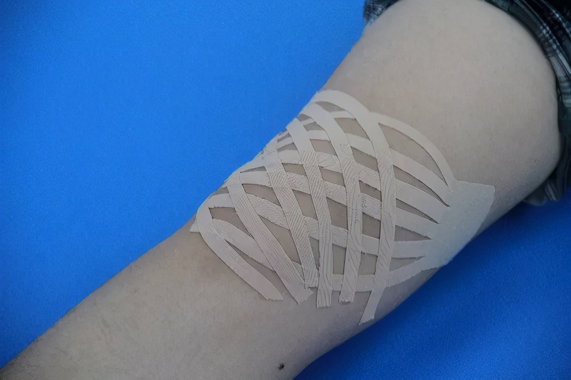 弹性贴布的原理,弹性贴布的作用