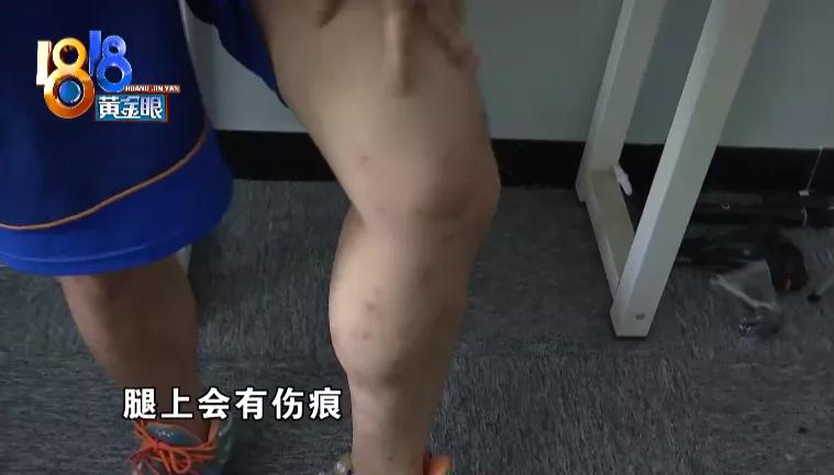 床上出现褐色小虫子书虱,背上长满小疙瘩是螨虫的房子吗