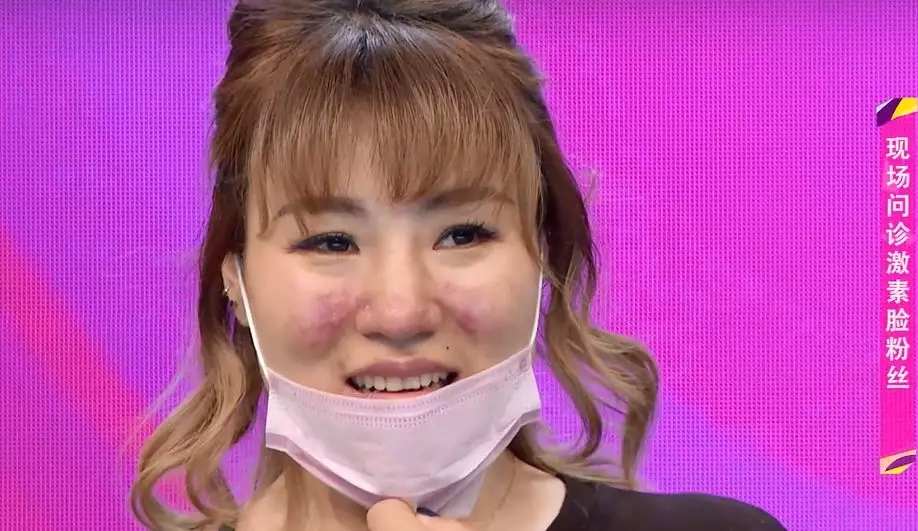 全球公认最好的10款祛痘膏,超好用的一款祛痘膏