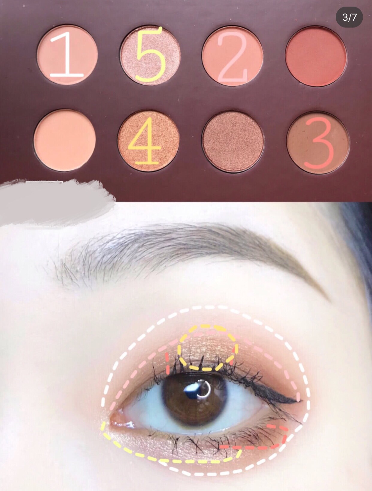 单眼皮肿眼泡不化妆怎么变美,单眼皮肿眼泡不做手术怎么改善