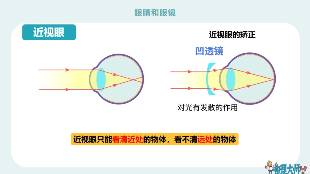 初二物理眼睛与眼镜难题,初二物理眼睛与眼镜讲解视频