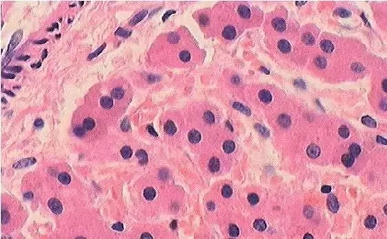 吃了毒蘑菇只会上吐下泻?这株“毁灭天使”让你成为活死人