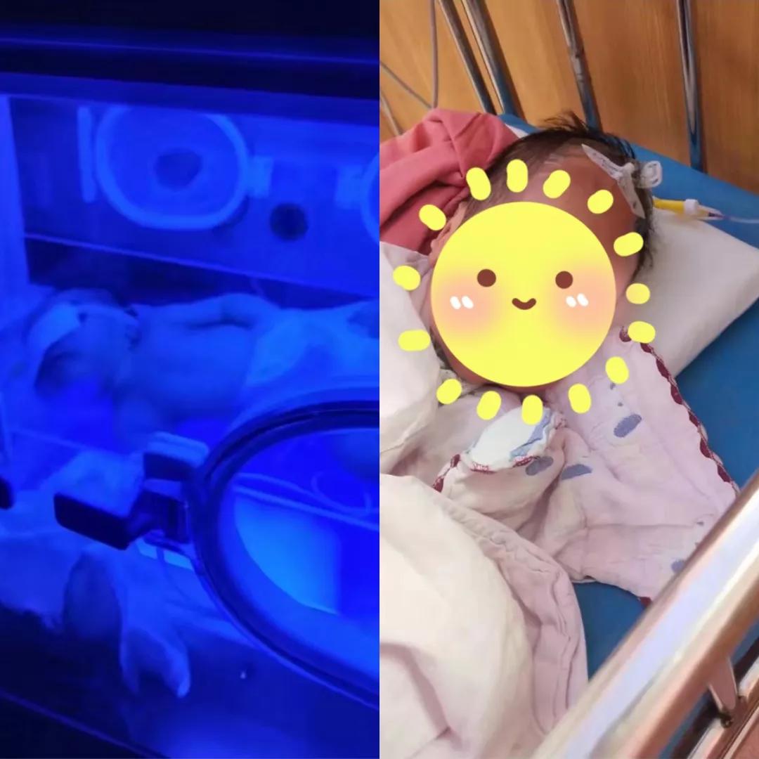 梗阻性黄疸的护理诊断及护理措施,宝宝黄疸如何彻底解决