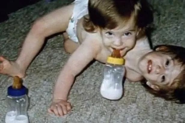 诡异双头人,最诡异的双头连体人