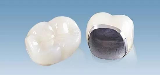 做完根管治疗，牙医还让我戴牙冠，是套路吗？#雅悦齿科#