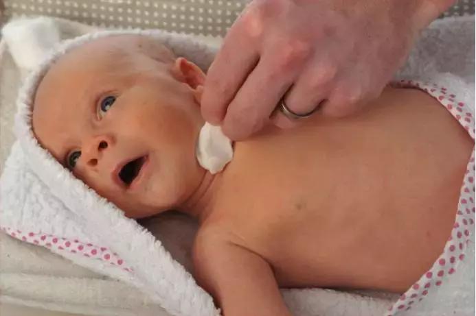 宝宝高热惊厥不要慌,家长做对这几点宝宝才能安然无恙