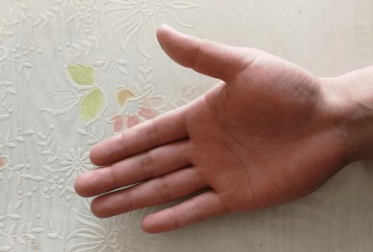 中年妇女手指疼痛僵硬是什么原因,老人手指腱鞘炎如何治疗