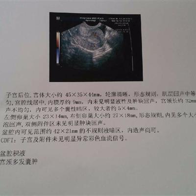 没有停经史会出现先兆流产吗,停经小腹隐隐作痛的原因
