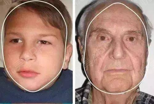 人衰老面部变化,面部衰老改善最好的方法