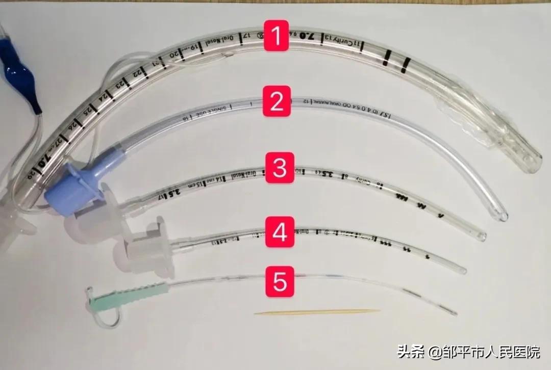 牙签般的细管，救了32周早产儿