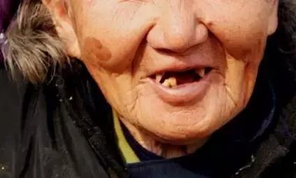 牙齿公益广告,2021年缺失牙公益援助行动