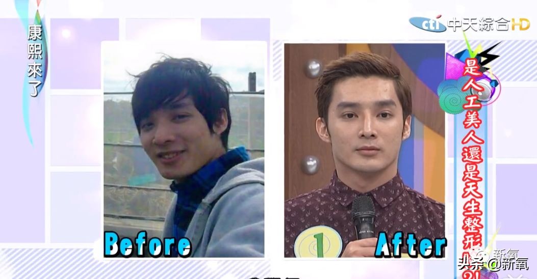 花90万从头整到脚,还可以这么自然?旁边纯天然小姐姐都看懵了