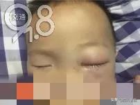 男孩被化学药水弄瞎眼睛,男孩被化学药水弄了眼睛