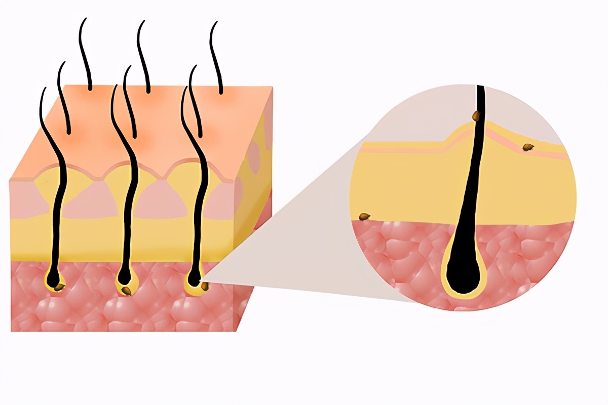 脖子和头皮上长疙瘩发痒怎么回事,老人头皮发痒起小疙瘩是什么原因