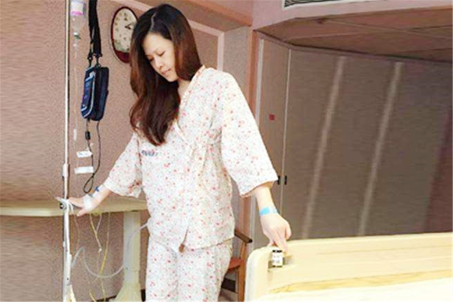 剖腹产美容线和要拆线有什么区别,剖腹产是用美容线好还是进口线好