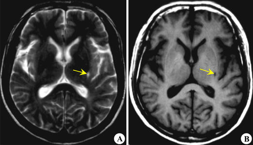 反复出现头晕吃什么药管用,一直反复头晕是怎么回事会不会死