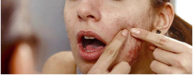 反孔大作战专治你的毛孔粗大