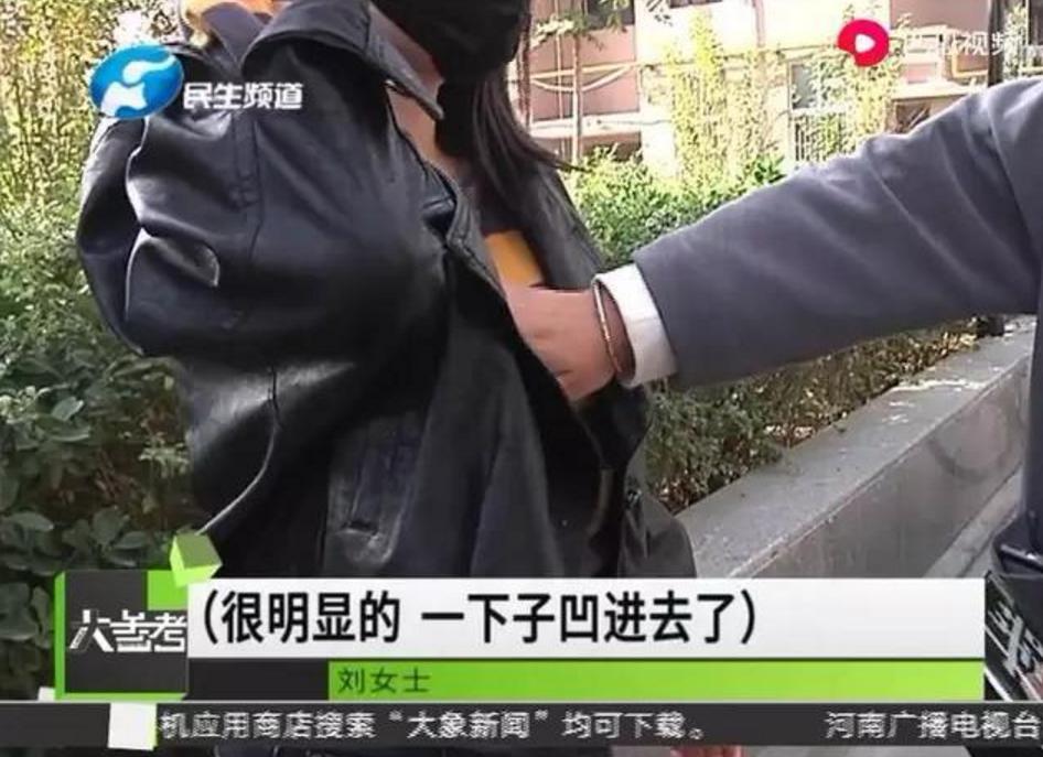 女子丰胸手术后变三胸,女子多次隆胸后体内有10个假体