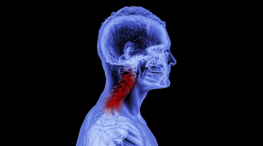 颈椎腰椎生理曲度变直怎么办,脖子颈椎生理曲度变直怎么办