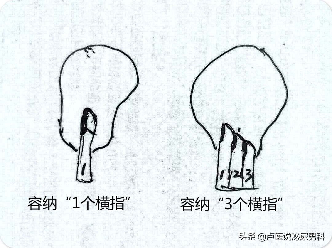 怎么锻炼盆底肌凯格尔运动,盆底肌训练凯格尔运动教程