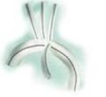 血透内瘘球囊扩张术痛吗,血透导管堵塞如何溶栓