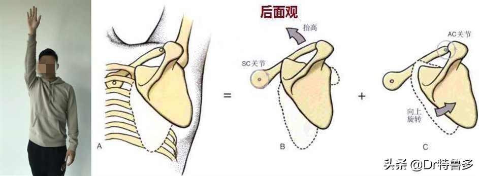 蝴蝶骨不是一种病吗,蝴蝶骨是颈椎病吗