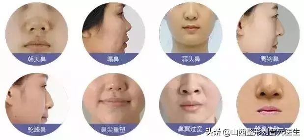 捏鼻子能让鼻梁变高,婴儿捏鼻梁变高真的吗