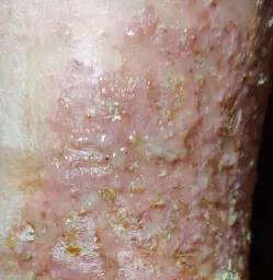 璋﹀窛涓尰,鏉窞璋﹀窛涓尰