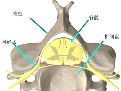 在我们身边的隐形杀手,警惕我们身边的隐形杀手冠心病