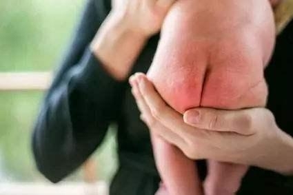 孩子皮肤干燥怎么护肤好,小孩皮肤太干燥怎么调理