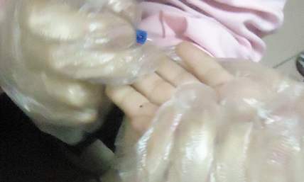 小孩积食在手指哪个部位刺血,积食扎手指放血大人