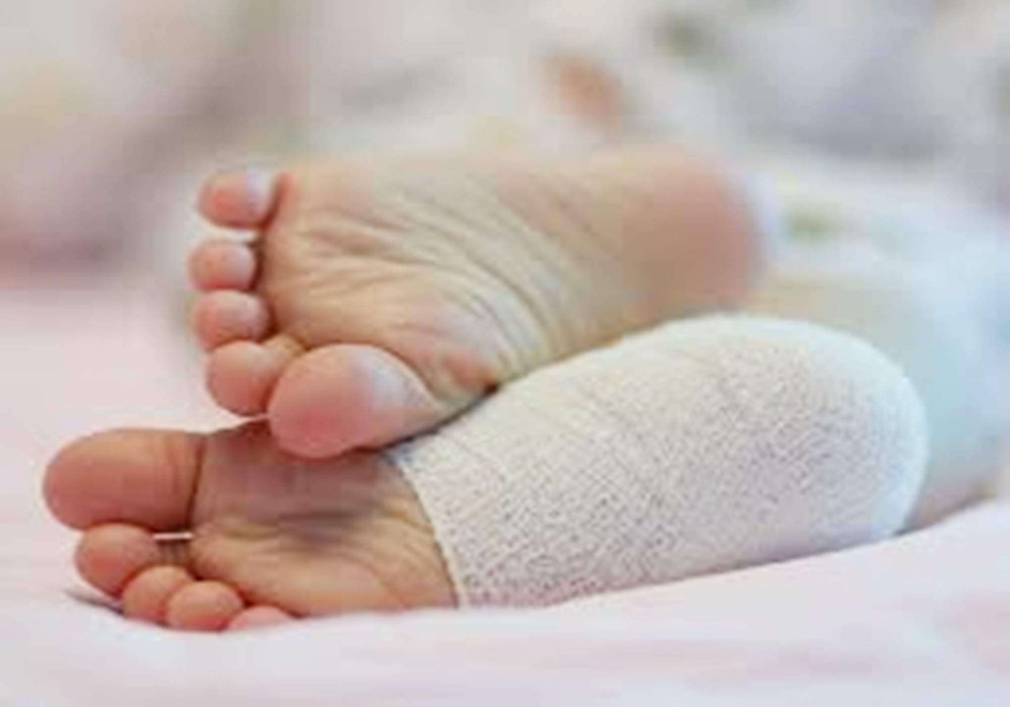 五岁儿童穿高跟鞋脚变形,五岁女孩脚趾变形