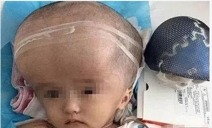 喝了12年的三鹿奶粉,当年喝三鹿奶粉的孩子怎么样了