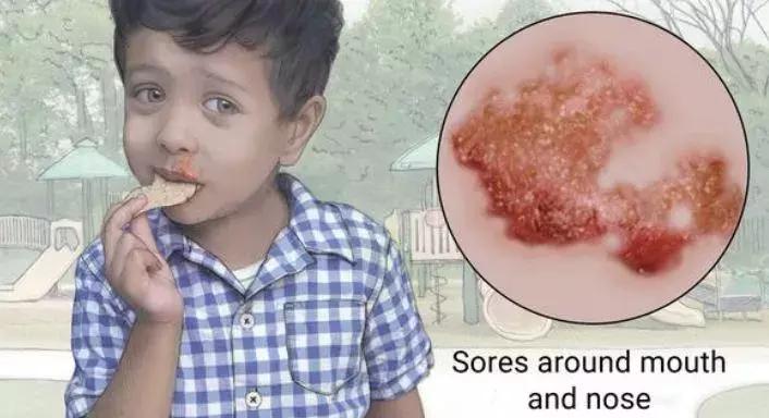 我这手怎么就这么贱呢表情包,手好贱