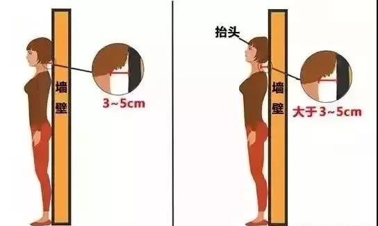 如何解决含胸驼背问题,你含胸驼背的样子