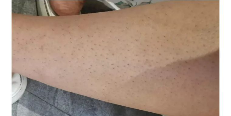 j-style脱毛仪怎么用,j-style脱毛仪怎样