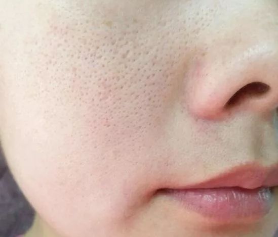 肌肤缺氧,肌肤从什么时候开始就缺氧了