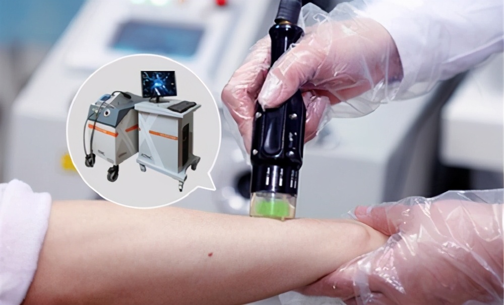 10600点阵激光治疗白癜风有效果吗,激光治疗白癜风能治好吗