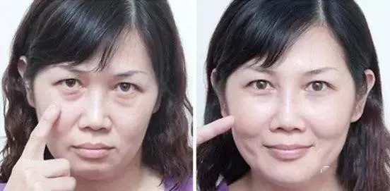 眼霜抗皱去细纹什么平价品牌最好,平价好用适合60岁妈妈用的眼霜