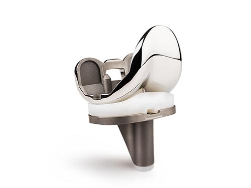 世界首例!我国华西医院成功植入3D打印生物型人工膝关节