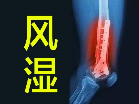 风湿哪些饮食推荐吃药调理,类风湿药膳食谱猪脚