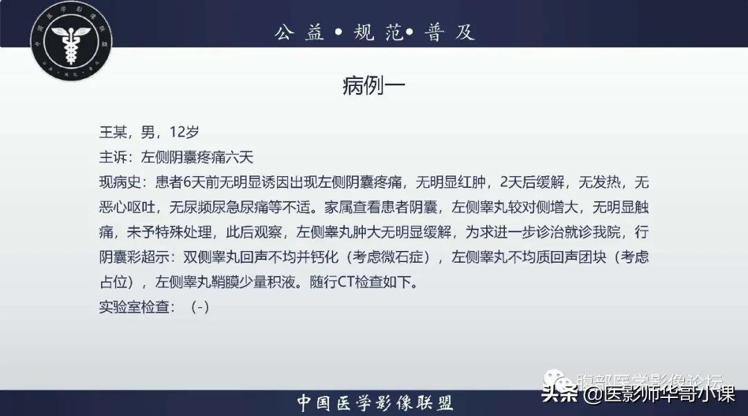 [精品课件]畸胎瘤及精原细胞瘤（*丸睾**肿瘤及肿瘤样变CT及MR表现）