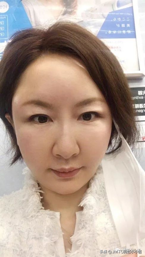 日本小姐姐针灸瘦脸视频,小姐姐打瘦脸针视频