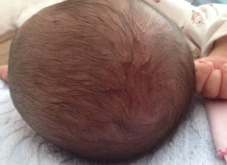 孕晚期吃鹅蛋怎么解胎毒,孕晚期吃鹅蛋可以去胎毒吗