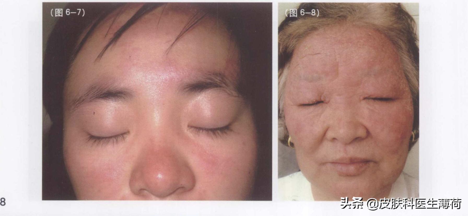 如何防止光老化氧化,预防光老化的最佳方法