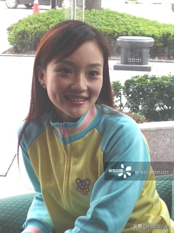 有哪些明星过度整容惨不忍睹,整容失败女明星今昔对比