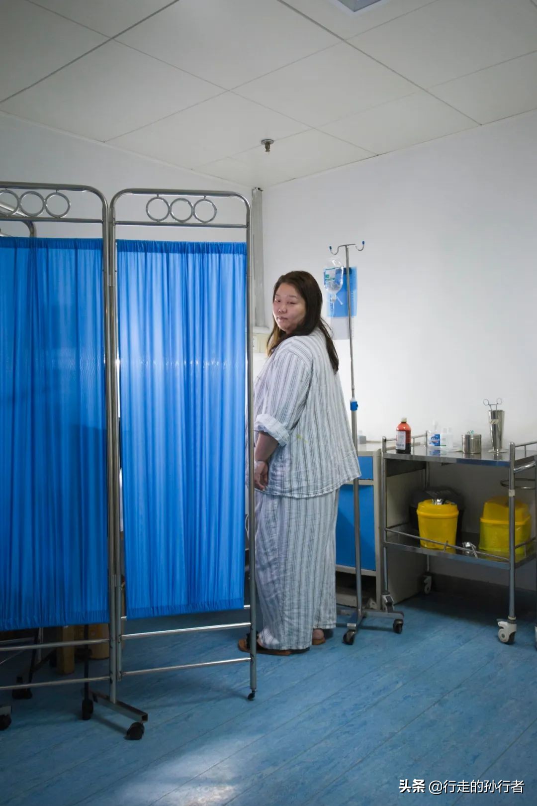 切胃减肥手术的副作用,为了减肥切胃到底值不值