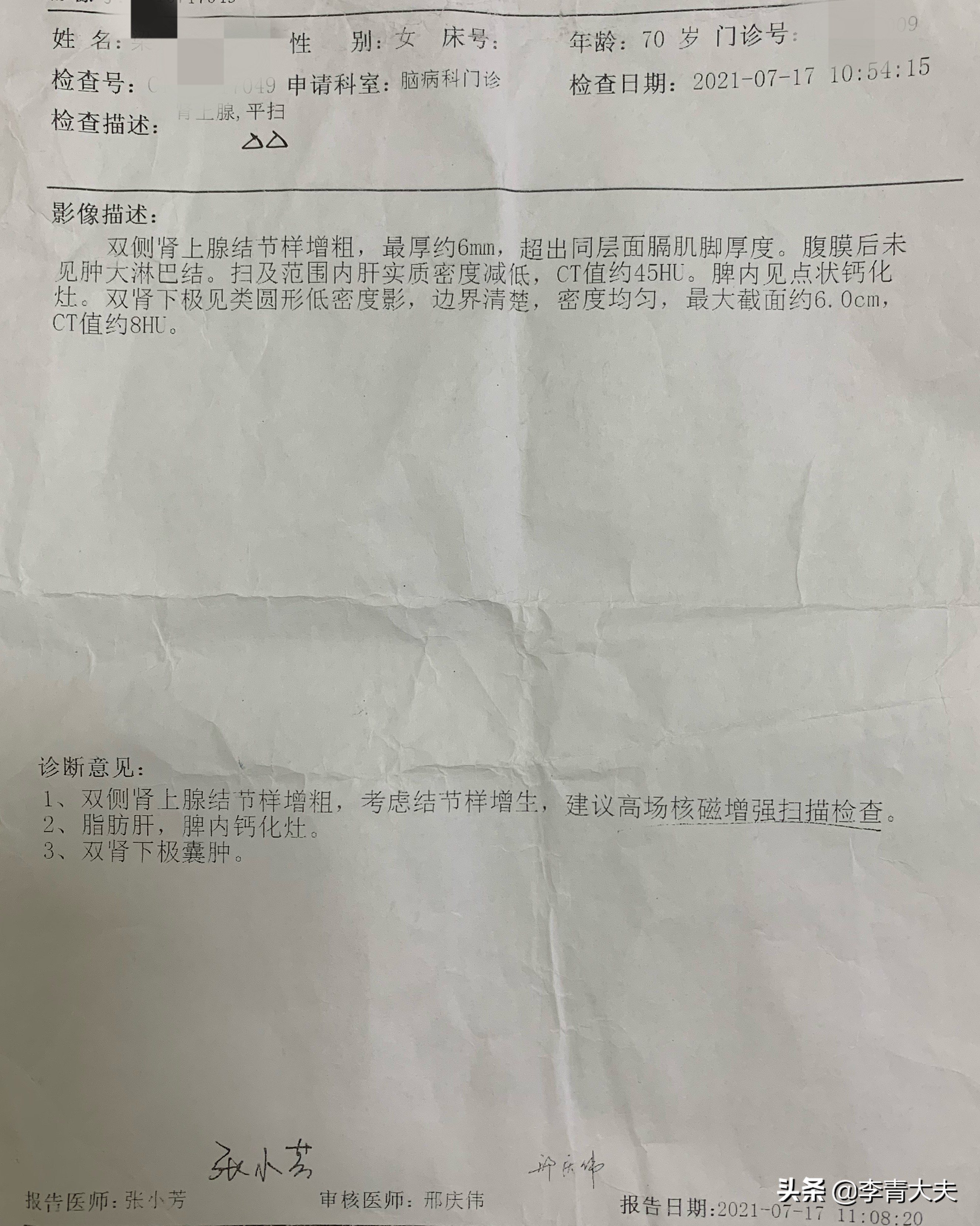 高血压合并肾病的概率,高血压低钾考虑哪种继发性高血压