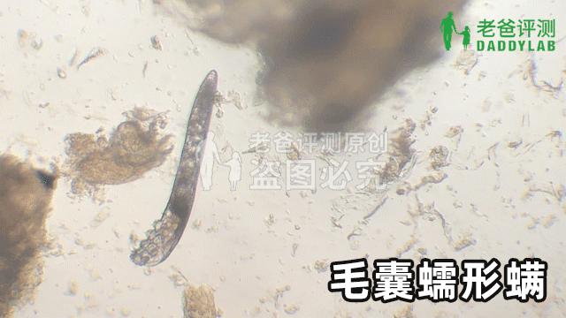 脸上发现蠕形螨虫,别人脸上的螨虫会爬到自己身上