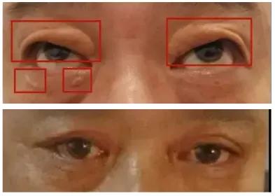 40岁脸部衰老的征兆,中年脸部发生变化是好是坏